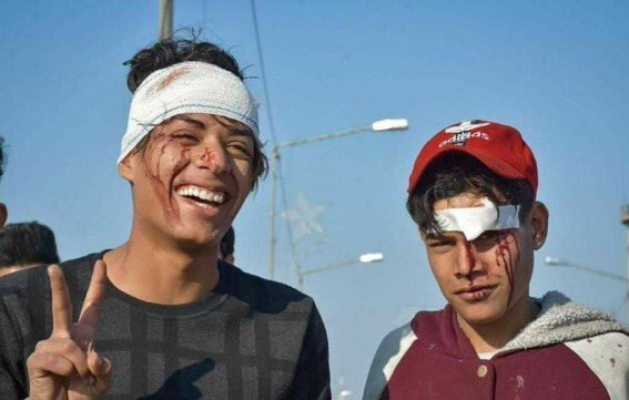 صورة بالف معنى ....
الابطال يبقون ابطال 
كفاكم قتل ابنائنا