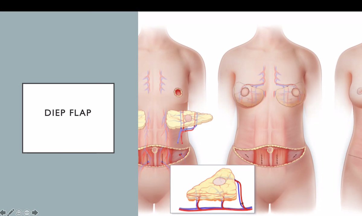 qubscrubs's tweet photo. A brilliant talk, with some amazing videos on the Future of Plastic Surgery by our final keynote speaker, Miss Ciara McGoldrick🌟 https://t.co/WnrPNJaUnm