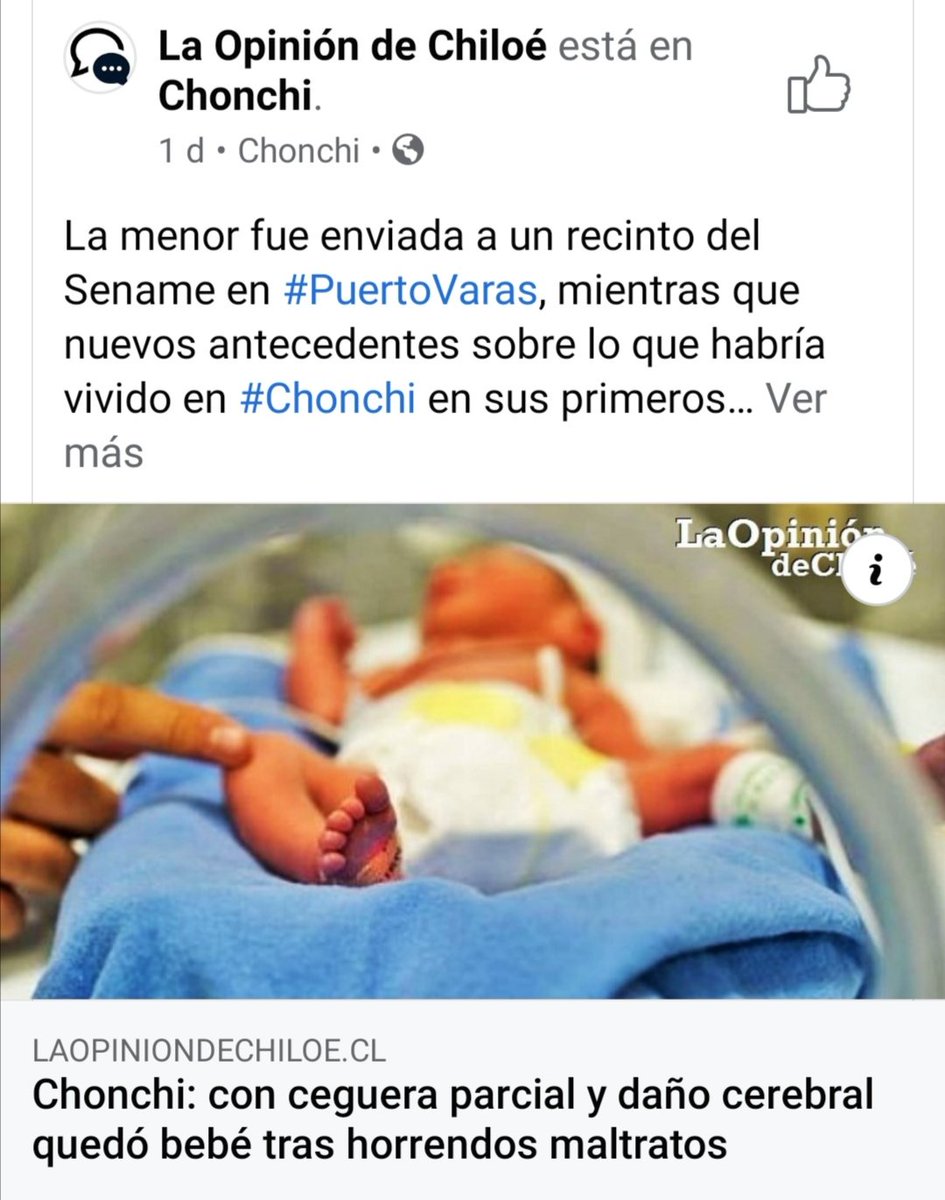 MariteTelloT's tweet photo. #justiciaparatomasito y justicia para esta pequeña en Chonchi, ya basta de abusos, maltratos y muertes de menores..
Chonchi: con ceguera parcial y daño cerebral quedó bebé tras horrendos maltratos
#terremoto https://t.co/T0iqbnOJ75