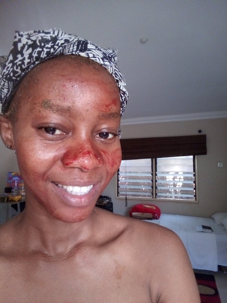 Priscilla Philips On Twitter Tashimkhabela Saw Your Beautiful Period Blood Face Mask Thought I Share This With You Also I Drink Mine I Mediate Pray With My And Use It As