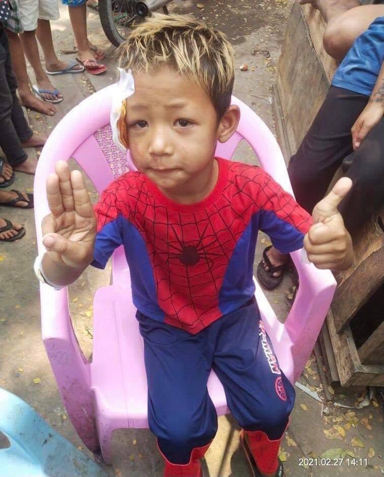 PannEain95's tweet photo. The boy was beaten by the military and police. #SaveMyanmar #CrimesAgainstHumanity #AgainstMyanmarMilitaryCoup https://t.co/HwdU0s2EVt