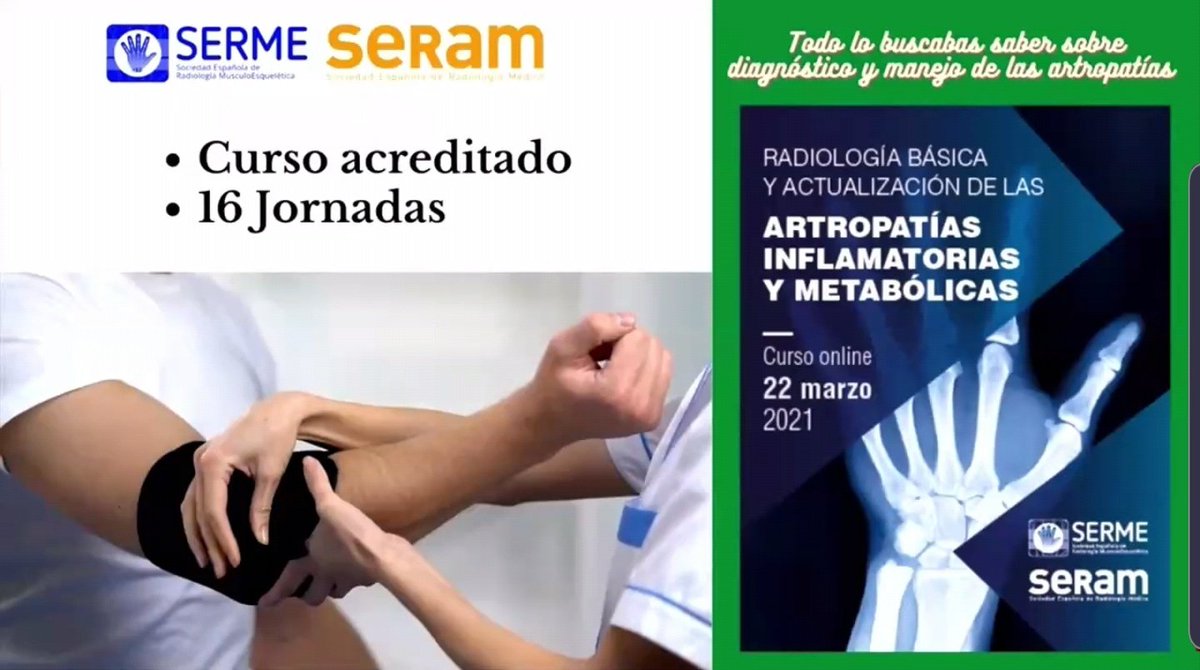 MskSerme's tweet photo. Pronto tendréis noticias de más actividad de la #SERME online en https://t.co/c9xoykWqYd

"Curso de artropatías inflamatorias y metabólicas"

Acreditado por @SERAM_RX
#MSKRad https://t.co/S8p453GS5t
