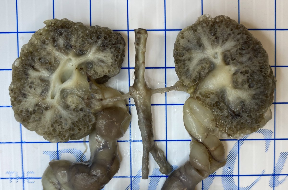 dianapath1's tweet photo. #CaseOfWeekend Male 26WG #Pedipath #Fetalpath #Pediatrics #SoMePathology #Pathology #PerinatalPath https://t.co/oNNmAWPhbm