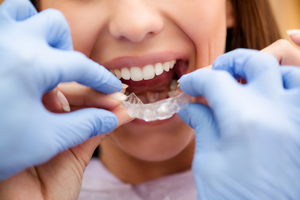 StieperBrust's tweet photo. The perfect smile you’ve always wanted is within your reach! 😁 Our friendly doctors will provide a free smile consultation and put together a care plan specifically tailored to your needs. Learn more: https://t.co/LpuzL2qMmt https://t.co/9YNArcLW49