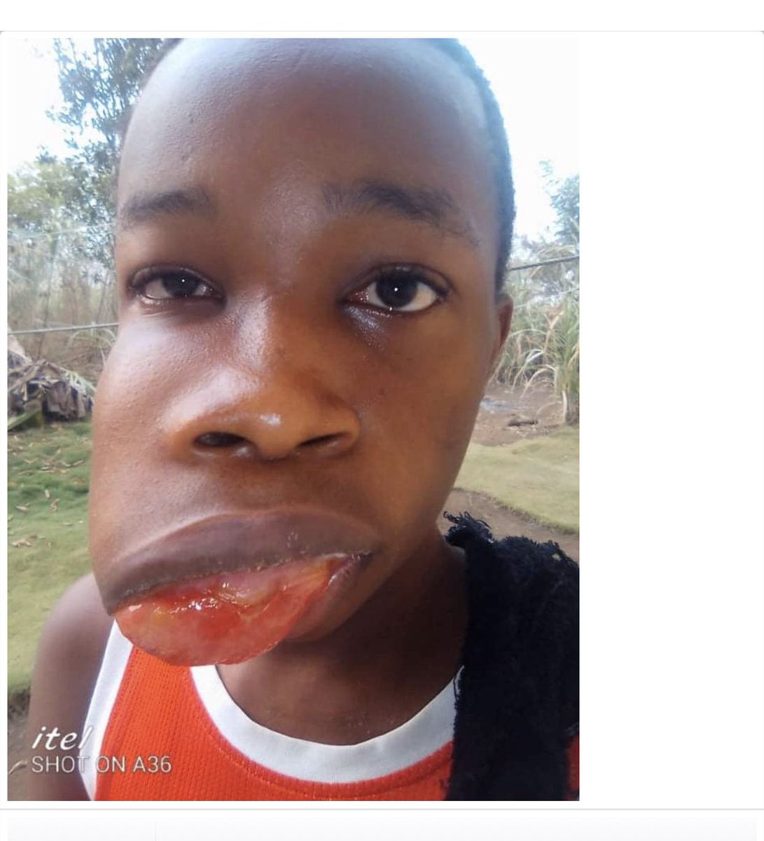 wokobucci's tweet photo. Young Cameroonian with cancer please help, PayPal-rolandtnkwanyuo@yahoo.com

Cash app -$krolmic 

 Momo-652206662
Kome Deline

Bitcoin-1M1QbA2LCvzwouHv4SaDdjRKEuoXGD6cfX https://t.co/JX5fRdbuAr