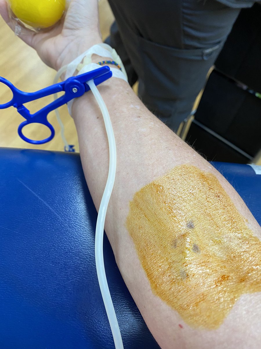 ocala_phc's tweet photo. 🩸🦜THANK YOU to the AMAZING Team at LifeSouth for all that they do! Another successful Blood Drive for the Ocala Parrot Head Club! 🩸🦜 #ocalaparrotheadclub @LifeSouth @ocala_phc https://t.co/15hFBDB64T