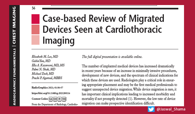 Jaswal_Shama's tweet photo. 𝐑etained 𝐒urgical 𝐈tems (RSIs) can be missed on imaging.😯Are you aware of the mitigation strategies?
👀👇
https://t.co/jQDet9R4tM
Follow👉#RadTweetorial🧵#𝐕𝐢𝐝𝐞𝐨𝐓𝐮𝐭𝐨𝐫𝐢𝐚𝐥📹#Radiology #ChestRad
#RadRes #RadInTraining #RadEd #FOAMRad #RGphx
1/13 https://t.co/hdGgwwh8D3