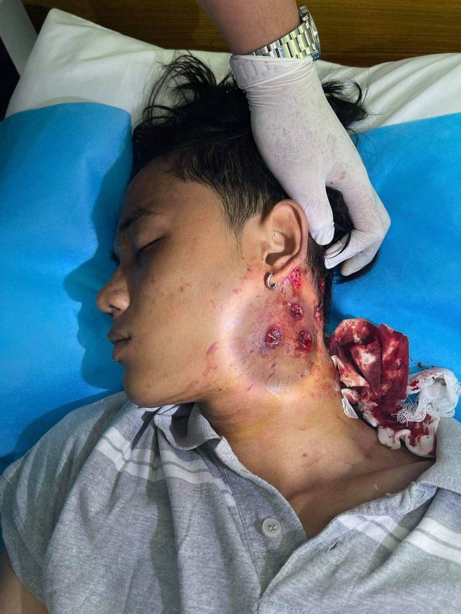 Yimon71937633's tweet photo. Myanmar military is killing peaceful protesters!! International community should take serious action! Please! People are dying while you guys are expressing your concern on statements and papers!
#myanmarmilitarycoup #WhatsHappeningInMyanmar @freya_cole @RapporteurUn @MayWongCNA https://t.co/9ijiXNFG75
