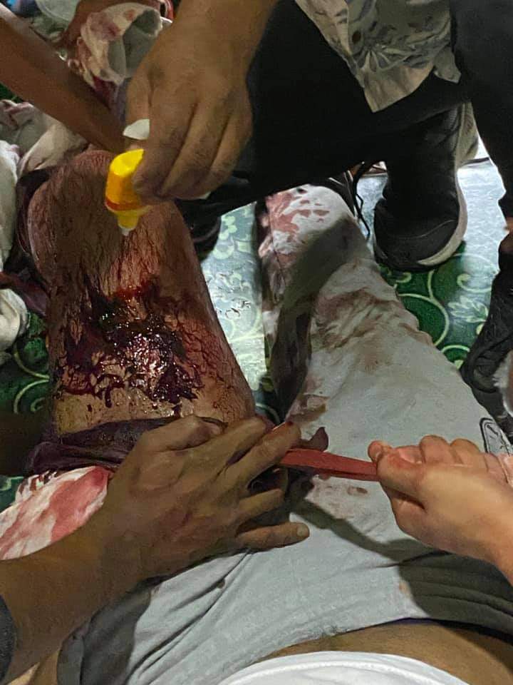 It's believed to be the real ammunition today in Hledan. Reportedly one demonstrator got injured. #MilkTeaAllianceMyanmar