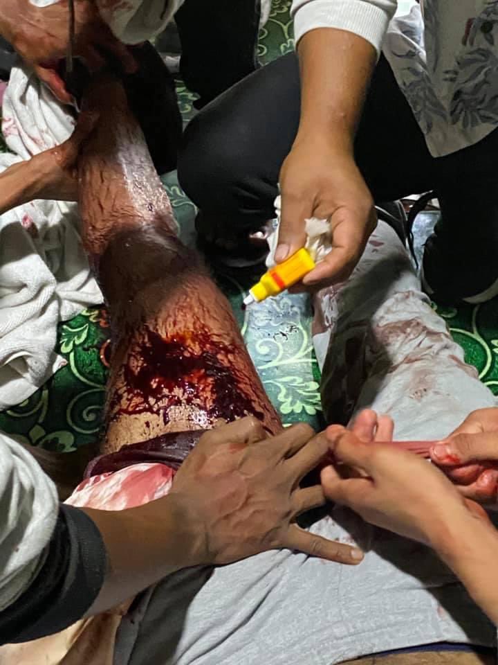 TW: gunshot ,Blood 
Military start fired people with real bullets ! 

Happening now 🚨
📍Hleden ,Yangon 
 <a href="/YourAnonCentral/">Anonymous</a> 
#MilkTeaAlliance 
#Feb28Coup 
#WhatsHappeninglnMyanmar