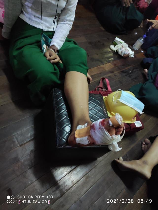 Teachers protesters receiving medical treatment at nearby hideout after got hurt while they ran away from police who attacked them with stun grenade this morning in Yangon on Feb 28 #WhatsHappeningInMyanmar