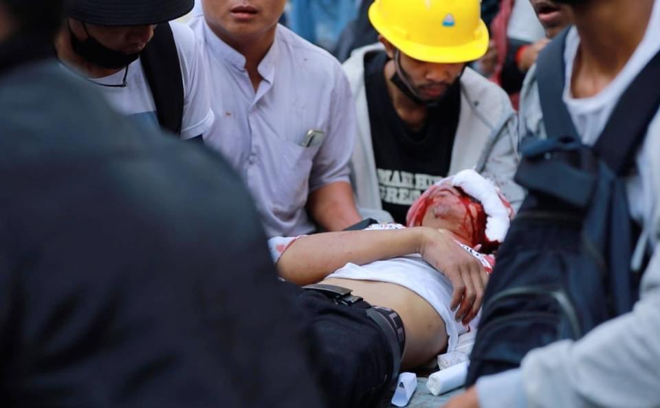 win_sera's tweet photo. Police military junta crackdown our protesters mostly young ppl and shoot with real guns ,today 28 February just now happening in Hlendan , many of those injured, help us @YourAnonCentral @UN @ICJ_Asia #HearTheVoiceOfMyanmar https://t.co/nMrLwjKmkB