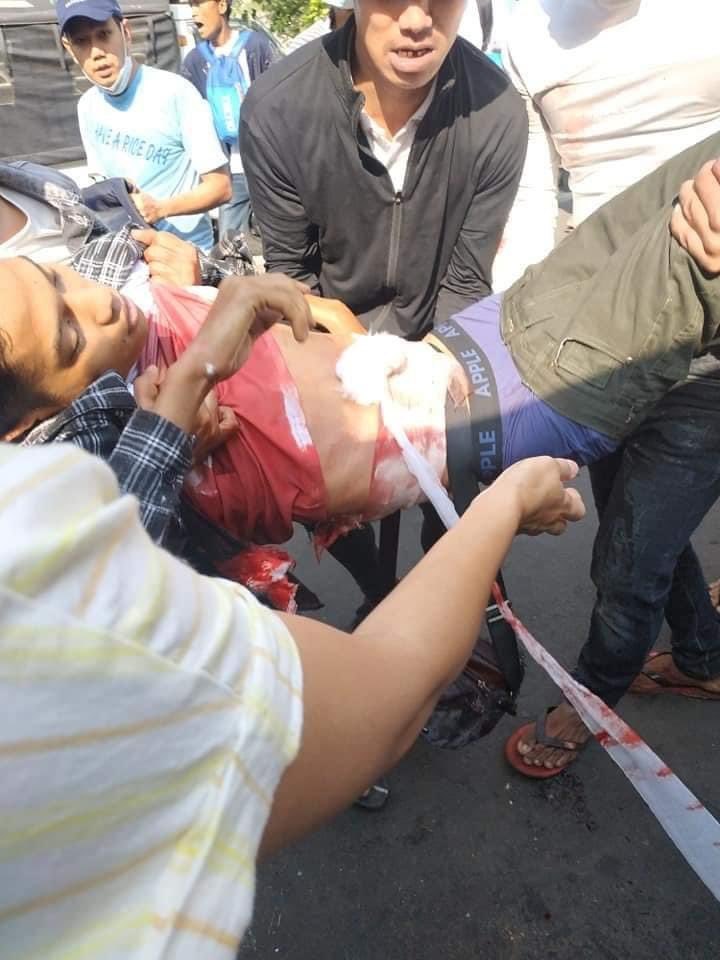 kyi4320's tweet photo. Military shoot with the Gums in Myanmar Now.
28 Feb, Now, All over Myanmar, many were injured and many died and many are arrested due to Military.
#milkteaalliancemyanmar 
#Feb28Coup 
#WhatsHappeninglnMyanmar https://t.co/l9SpShu8R1