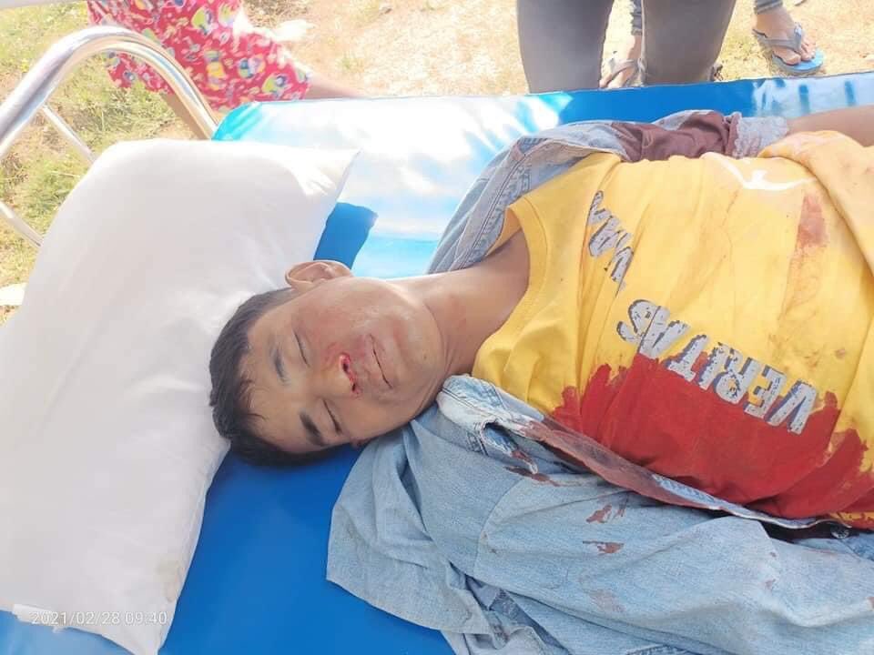 Pencilo4's tweet photo. Polices are committing crimes against humanity under Junta. At Yangon.

TW// Blood Wound

SPRING REVOLUTION

#MilkTeaAllianceMyanmar
#WhatsHappeningInMyanmar
#Feb28Coup https://t.co/3orFt9Tsgj
