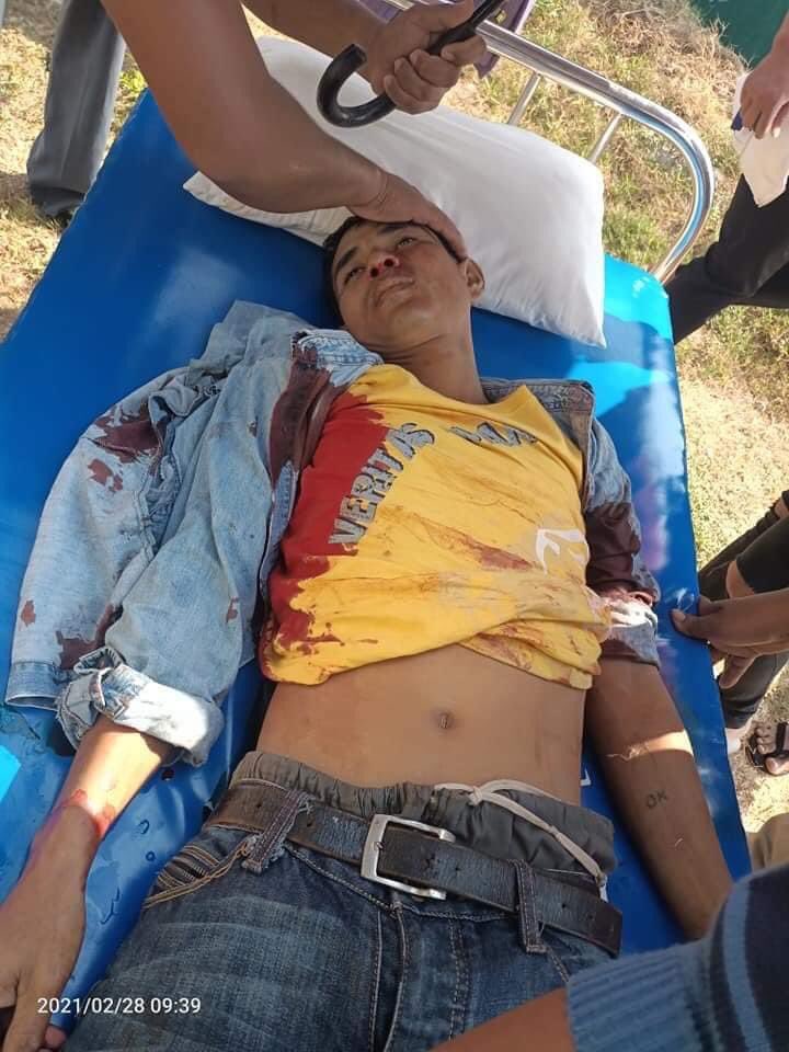 Pencilo4's tweet photo. Polices are committing crimes against humanity under Junta. At Yangon.

TW// Blood Wound

SPRING REVOLUTION

#MilkTeaAllianceMyanmar
#WhatsHappeningInMyanmar
#Feb28Coup https://t.co/3orFt9Tsgj