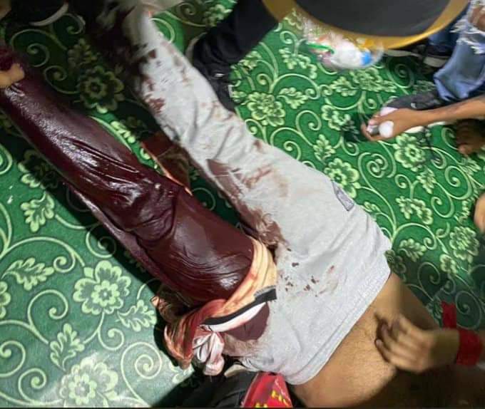 Hannwe14's tweet photo. TW: gunshot ,Blood 
Military start fired people with real bullets ! 

Happening now 🚨
Hleden ,Yangon 
 @YourAnonCentral 
#MilkTeaAlliance 
#Feb28Coup 
#WhatsHappeninglnMyanmar https://t.co/7XUsMZ6f4D