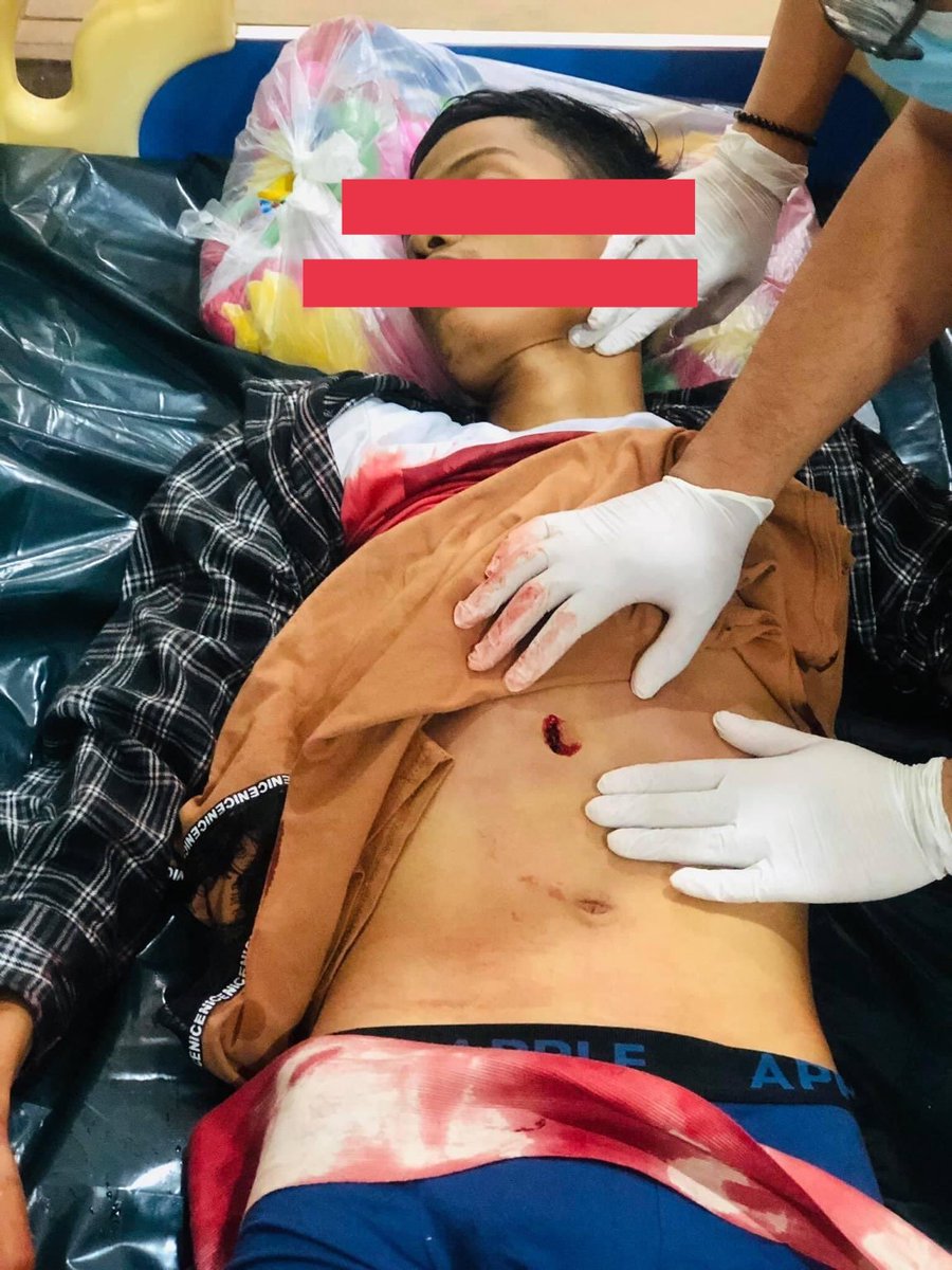 He's been shot to death just because he was protesting peacefully in Hledan, Yangon.
#Feb28Coup #WhatsHappeninglnMyanmar #HumanRightsViolationMyanmar