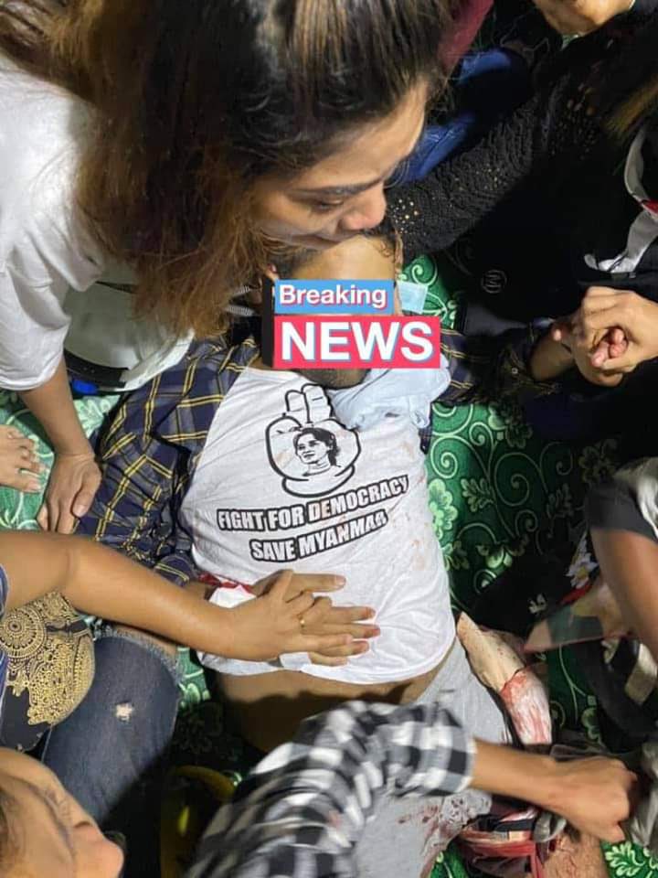 tw// blood
The crack down in Hledan, Yangon. They used live bullet and at least three got injuried! The one who got shot in the throat is sent to hospital!
#WhatsHappeningInMyanmar
#Feb28Coup
#MilkTeaAlliance
#MilkTeaAllianceMyanmar 
#OpCCP
