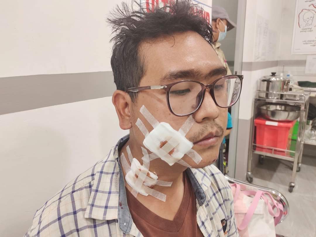 uthetkokooo2's tweet photo. We want justice for myanmar. https://t.co/RBbwiAnvS3