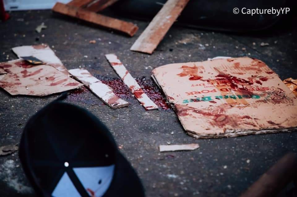 hwh1311's tweet photo. #HowManyDeadBodyNeedForUNtoTakeAction 

SPRING REVOLUTION
#Feb28Coup 
#WhatsHappeningInMyanmar #OpCCP 
@UN_HRC @YourAnonCentral @freya_cole @RapporteurUn
#MilkTeaAlliance
TW// Blood https://t.co/U1ibUNCPsg
