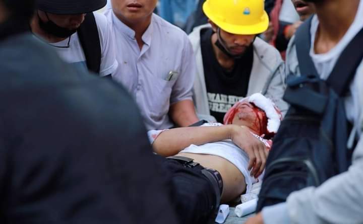 An Eye ? 
No...! Our Eyes.

#StopGunViolence 
#Feb28Coup
#StopMilitaryCoup 
#stop_police_brutallity 
#Save_Myanmar
#whatshappeningnowinmyanmar 
#MilkTeaAlliance 
#weneeddemocracynow