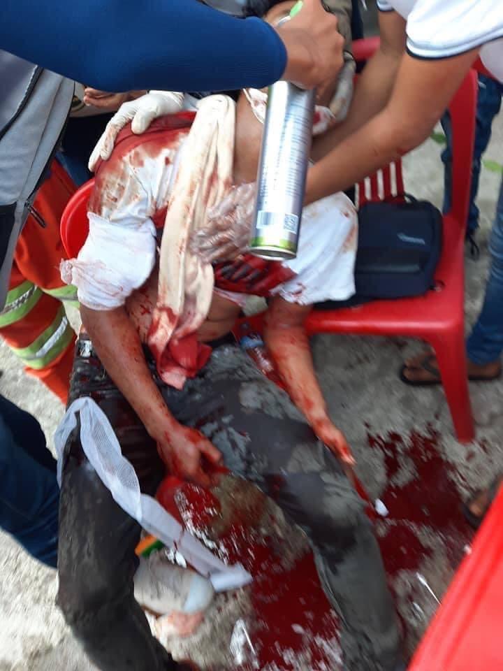 TW: gunshot ,Blood 

Happening now in Dawei , Tanintharyi Region ,Myanmar 🚨

 <a href="/YourAnonCentral/">Anonymous</a> 
#MilkTeaAlliance 
#Feb28Coup 
#WhatsHappeninglnMyanmar