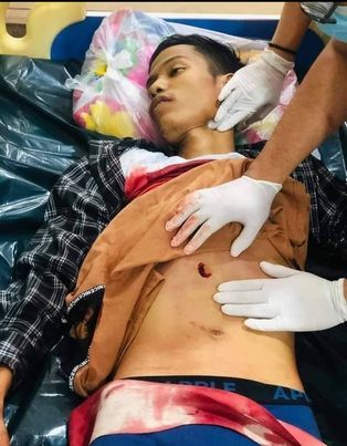 RinKaith's tweet photo. WHEN WILL WE BE GIVEN ATTENTION ?! 
THERE ARE DEATHS IN MYANMAR TODAY 28/2/2021
A PREGNANT TEACHER DIED, SHOT BY THE JUNTA
GENERATION Z KIDS DIED, shot by the JUNTA!
WHEN WILL THE WORLD NOTICE THIS ?!
HELP US, PLEASE! 
PLEASE TAKE ACTION NOW!
#SaveMyanmar 
#HearTheVoiceOfMyanmar https://t.co/kbp3Sef2KL