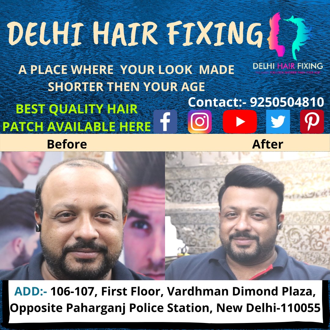 Delhi Hair Fixing (@DelhiHairpatch) / Twitter