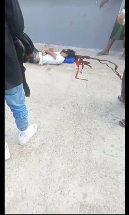 ThinMyatKyiZin (@thinmyatkyizin1) on Twitter photo Head Shot in MawlaMyine
TW//DEATH
TW//BLOOD
#WhatsHappeningInMyanmar
#Feb28Coup
<a href="/RapporteurUn/">UN Special Rapporteur Tom Andrews</a> <a href="/UN/">United Nations</a> <a href="/UN_HRC/">UN Human Rights Council</a> <a href="/freya_cole/">Freya Cole</a> <a href="/antonioguterres/">António Guterres</a> Head Shot in MawlaMyine
TW//DEATH
TW//BLOOD
#WhatsHappeningInMyanmar
#Feb28Coup
<a href="/RapporteurUn/">UN Special Rapporteur Tom Andrews</a> <a href="/UN/">United Nations</a> <a href="/UN_HRC/">UN Human Rights Council</a> <a href="/freya_cole/">Freya Cole</a> <a href="/antonioguterres/">António Guterres</a>
