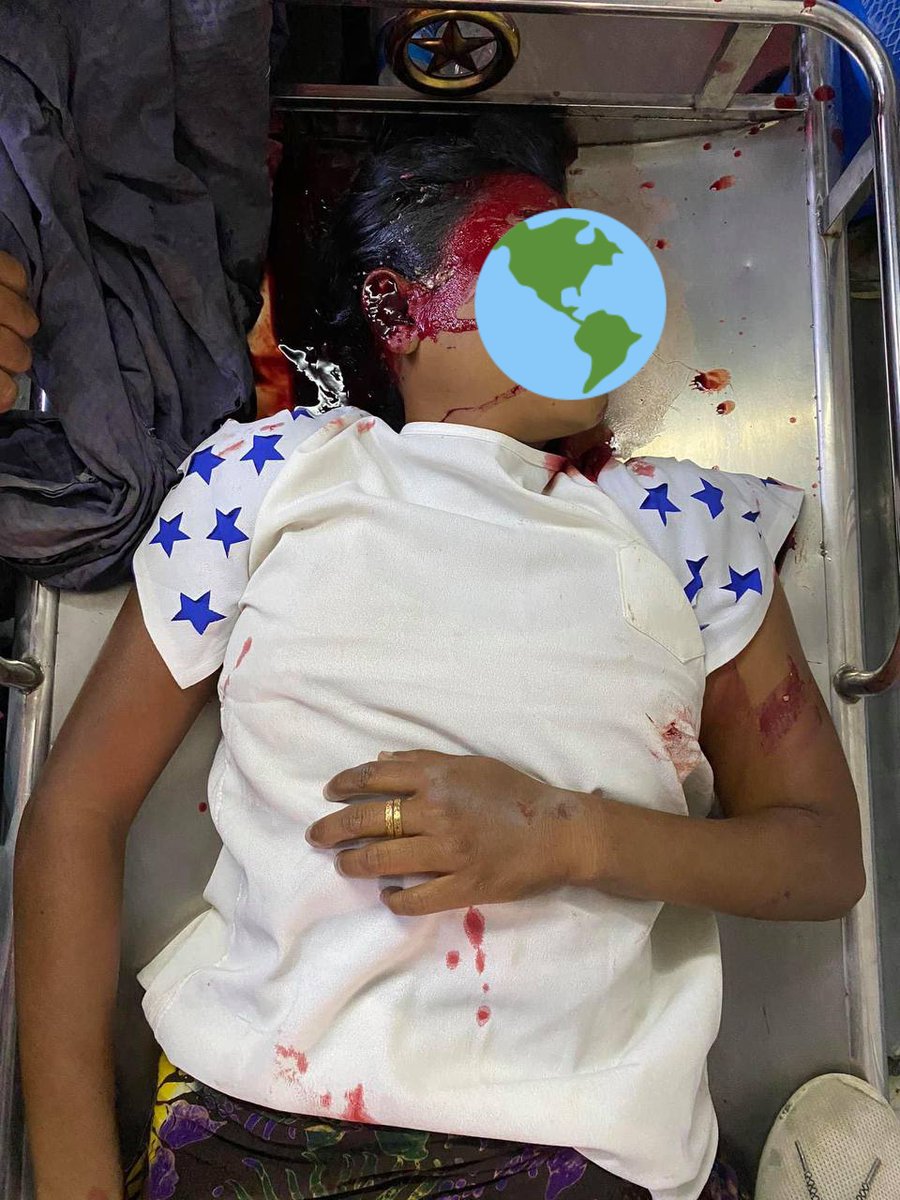 TW : death, gunshot,blood

The soldier truck shot to her head directly on 35 street of Mandalay!!She just passed away!The doctors didn't have time to save her!

These brutal police are still killing our people😭

SPRING REVOLUTION 
#MilkTeaAllianceMyanmar
#WhatsHappeningInMyanmar