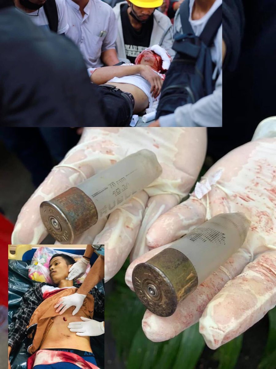 PaSaw14's tweet photo. @YangheeLeeSKKU And who is responsible for this unarmed civilians?
#Feb28Coup 
#WhatsHappeningInMyanmar #WhatsHappeningInAsia #MilkTeaAlliance #BurmeseSpringRevolution #SpringRevolution #AsianSpring 
tw // blood, gunshot https://t.co/LIjk7uFyCO