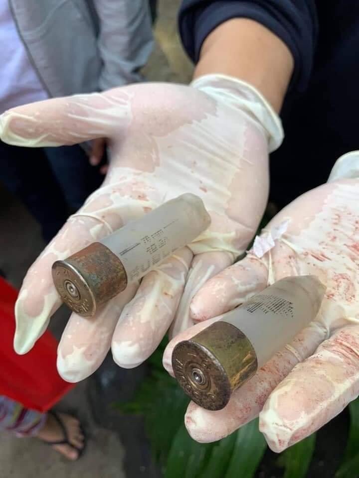 Two more dead in Yangon.

TW// Blood and Wounds 

#MilkTeaAllianceMyanmar
#WhatsHappeningInMyanmar
#Feb28Coup