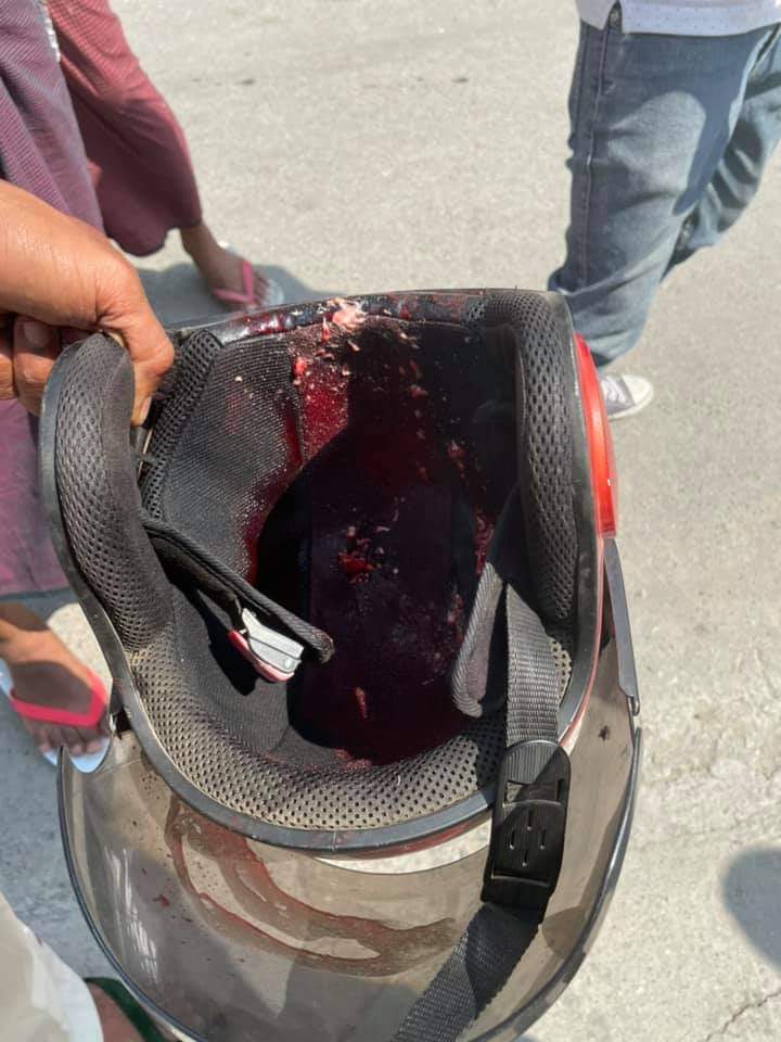 Mandalay, Myanmar
An unarmed protestors was shot down by the Sniper of the Military junta. Military using real bullets and even the snipers to crack down the protestors.
#CrimeAgainstHumanity 
#WhatsHappeninglnMyanmar 
#RejectMyanmarMilitaryCoup