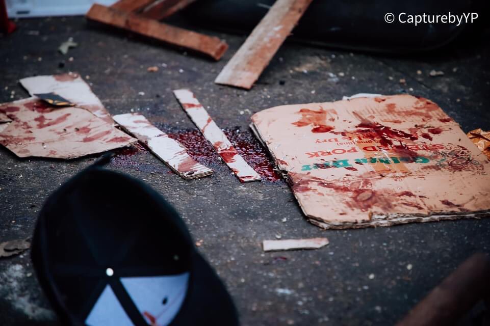 littlesexypd14's tweet photo. TW/ blood
Burmese police and soldiers opened fire on civilians, medical students and teachers, some with serious injuries and some dead, including pregnant women.
#Feb28Coup 
#MilkTeaAlliance 
#WhatsHappeninglnMyanmar https://t.co/8NJAjKibzu
