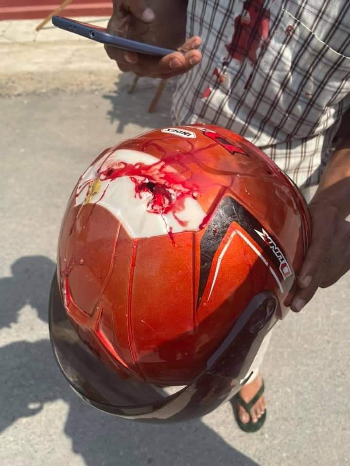 TW// Blood, Violence 
A civilian was shot in the head near 65 street and 41 street,Mandalay
The pieces of brain tissue in the helmet can been seen as in the photos.
SPRING REVOLUTION
#Feb28Coup
#MilkTeaAlliance 
<a href="/RapporteurUn/">UN Special Rapporteur Tom Andrews</a> 
<a href="/TostevinM/">Matthew Tostevin</a> 
<a href="/freya_cole/">Freya Cole</a>