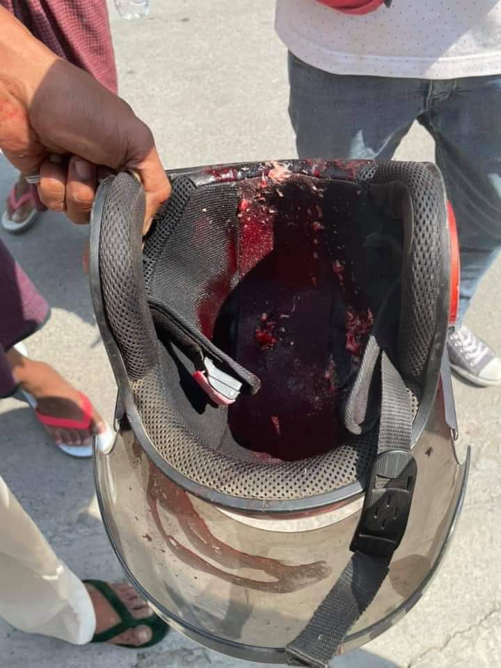 marn_khin's tweet photo. TW// Blood, Violence 
A civilian was shot in the head near 65 street and 41 street,Mandalay
The pieces of brain tissue in the helmet can been seen as in the photos.

#Feb28Coup
#MilkTeaAlliance 
#WhatsHappeningInMyanmar https://t.co/2AVQkx1bkS