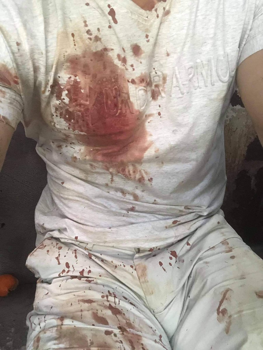 Tw // blood 
Ko Thura Win Htet, a student from Chinese Department, YUFL, was beaten to head crack(ခေါင်းကွဲ) and arrested by police. Now, he is being taken to Insein Prison. Please help this bro to be released asap. #WhatsHappeningInMyanmar #Feb28Coup