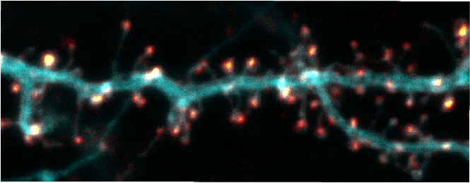 daniel_choquet1's tweet photo. The pre-print of our new paper "Bioorthogonal labeling of transmembrane proteins with non-canonical amino acids allows access to masked epitopes in live neurons" https://t.co/78UfzDNPJs @iins_bordeaux @LabSauer @INSB_CNRS @univbordeaux @biorxiv_neursci @Neuro_Bordeaux https://t.co/t0Yu22CAwK