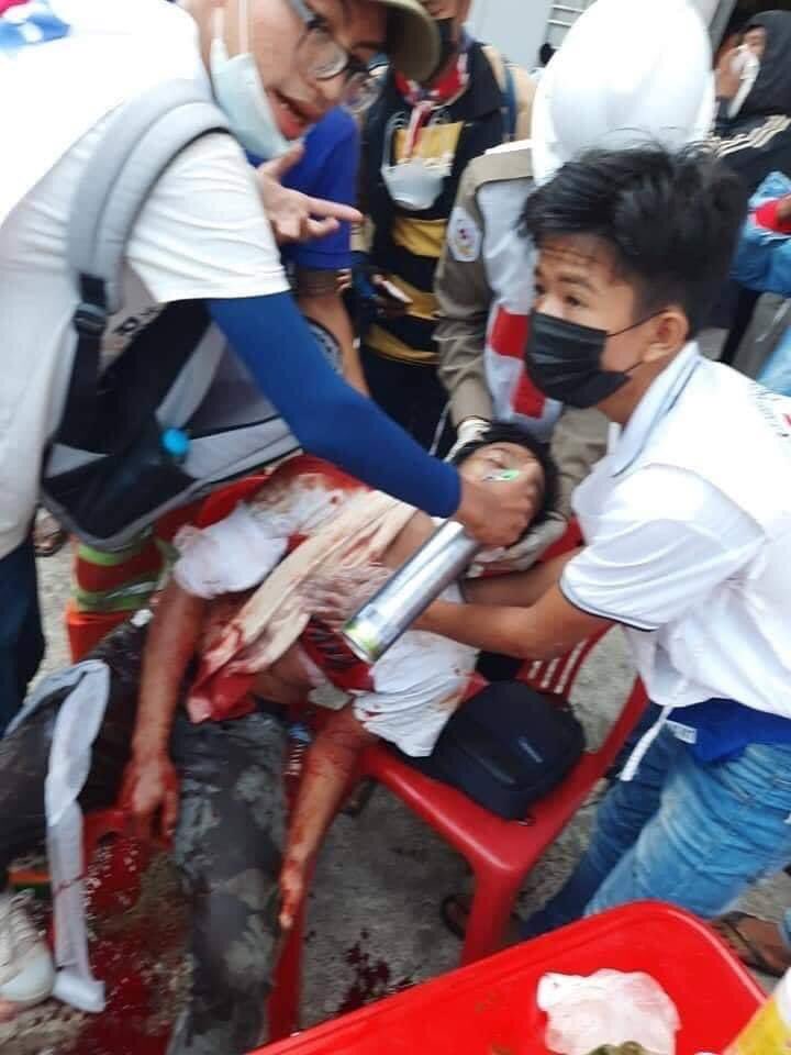 suchanms's tweet photo. Dawei this morning, a man got shot for several times with Real Bullets. He was in a severe condition. #WhatsHappeningInMyanmar #Feb28Coup #CrimesAgainstHumanity https://t.co/i6h9xUhAkB