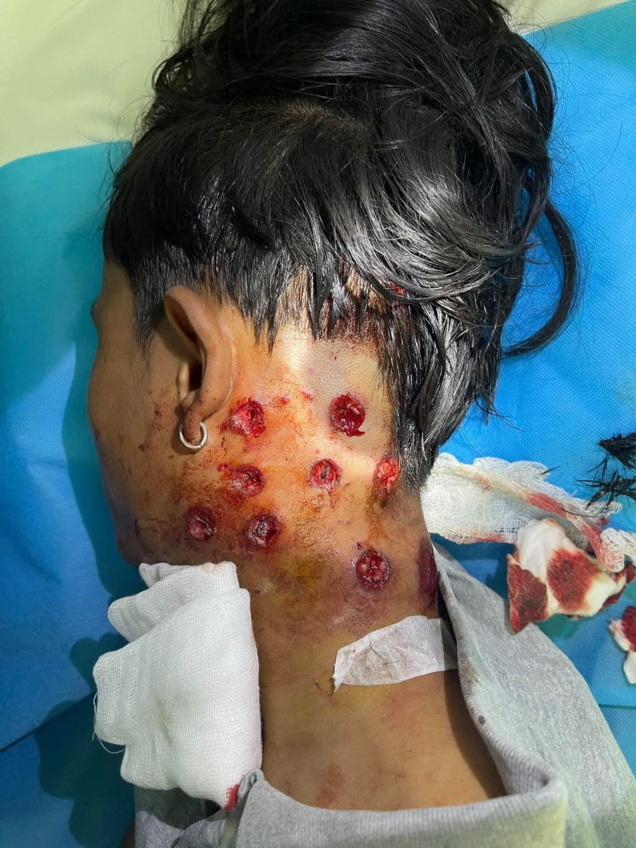 KayThiMyint_Eye's tweet photo. @Kemlu_RI oday is the deadliest day including a pregnant teacher and other unarmed civilians. @ASEAN #Indonesia supporting and discussion/talks with regime is supporting their human right violations. @UNHumanRights @RapporteurUn #WhatsHappeningInMyanmar #SpringRevolution https://t.co/hO66zT3sOc