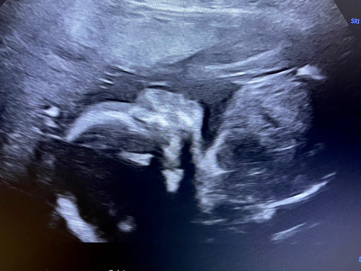 SimmerChlo's tweet image. 4 months til I meet my princess