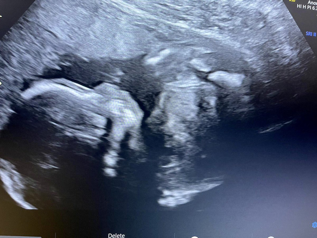 SimmerChlo's tweet image. 4 months til I meet my princess