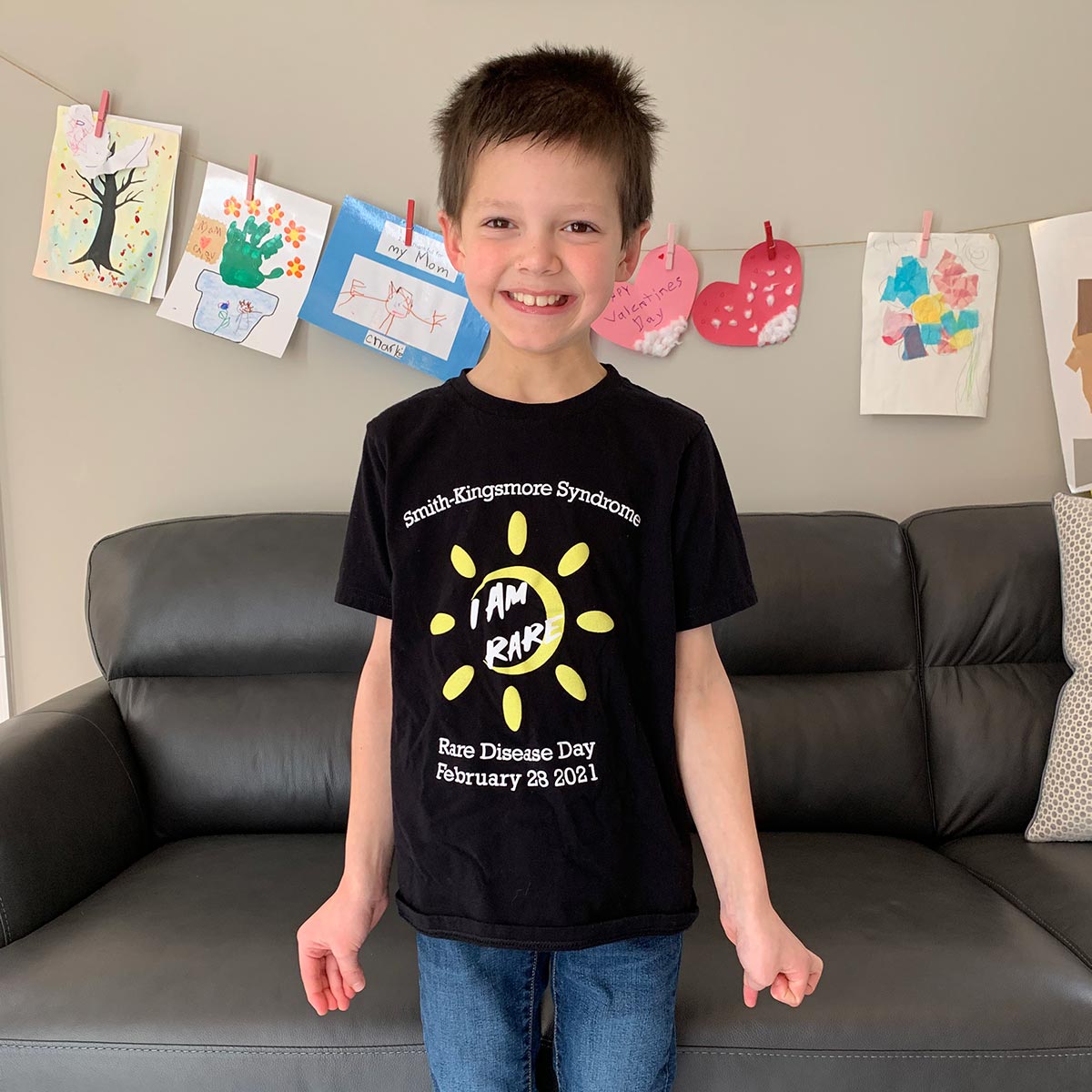 Meet Charlie Wilson, 9, one of our patients with a #RareDisease, Smith-Kingsmore syndrome.  Charlie’s mom, Sarah Lepore, is a @UVaNICU NP who helps raise money for research as a @SmithKingsmore board member. #RareDiseaseDay