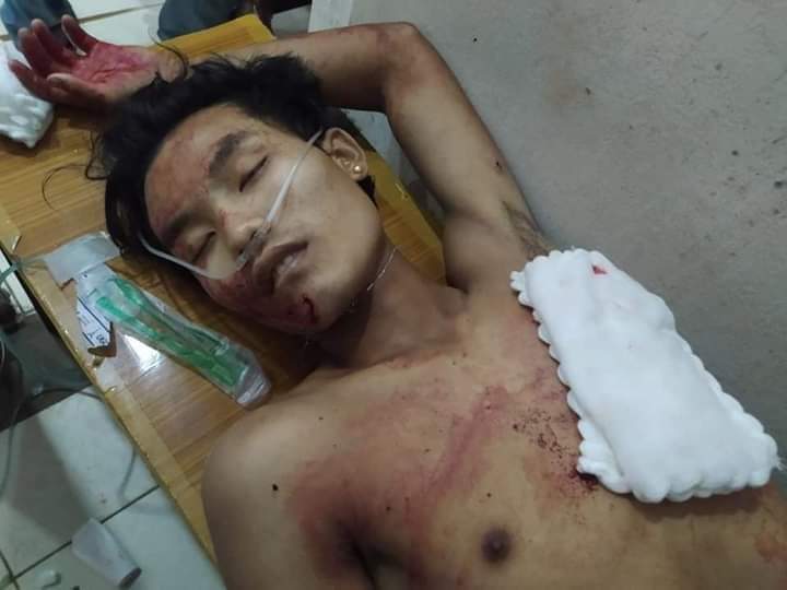 UnMyanmar's tweet photo. #SaveMyanmar 😭😭😭😭😭
#Help Myanmar https://t.co/h1UMSPGrni