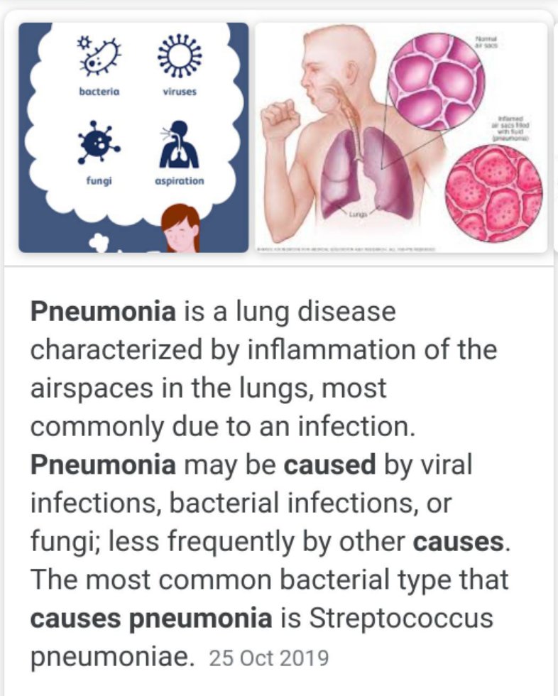 bitteroldqueen's tweet photo. @RichG83258568 @UKdemocrat Most of the "covid" deaths in the elderly were caused by prolonged wearing of damp masks. Pneumonia can be caused by viral infections, bacterial infections or fungi. Bacteria and fungi accumulated in damp masks would be perfect breeding grounds for pneumonia.
#wuastc https://t.co/w9MIGkjgkp