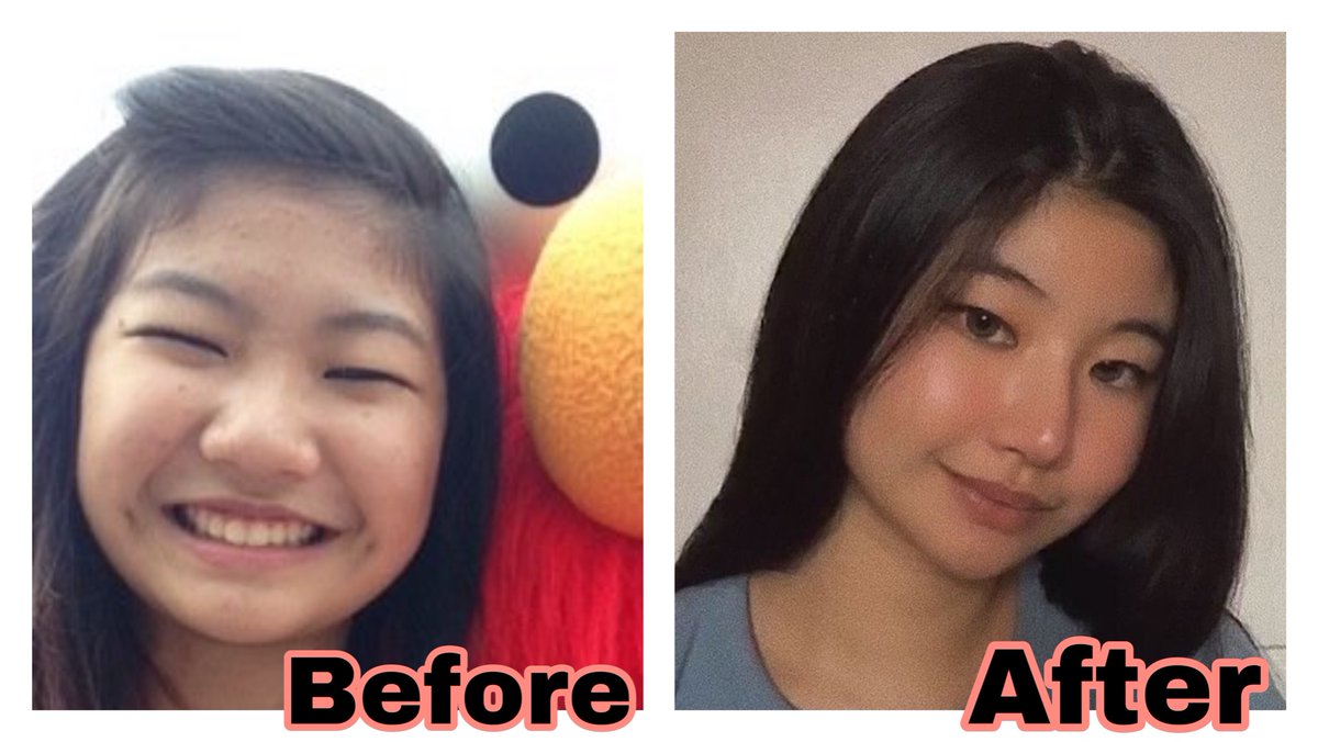 What Is Wrong With Yskaela Fujimoto Face: Did She Undergo Plastic Surgery Before? Explored