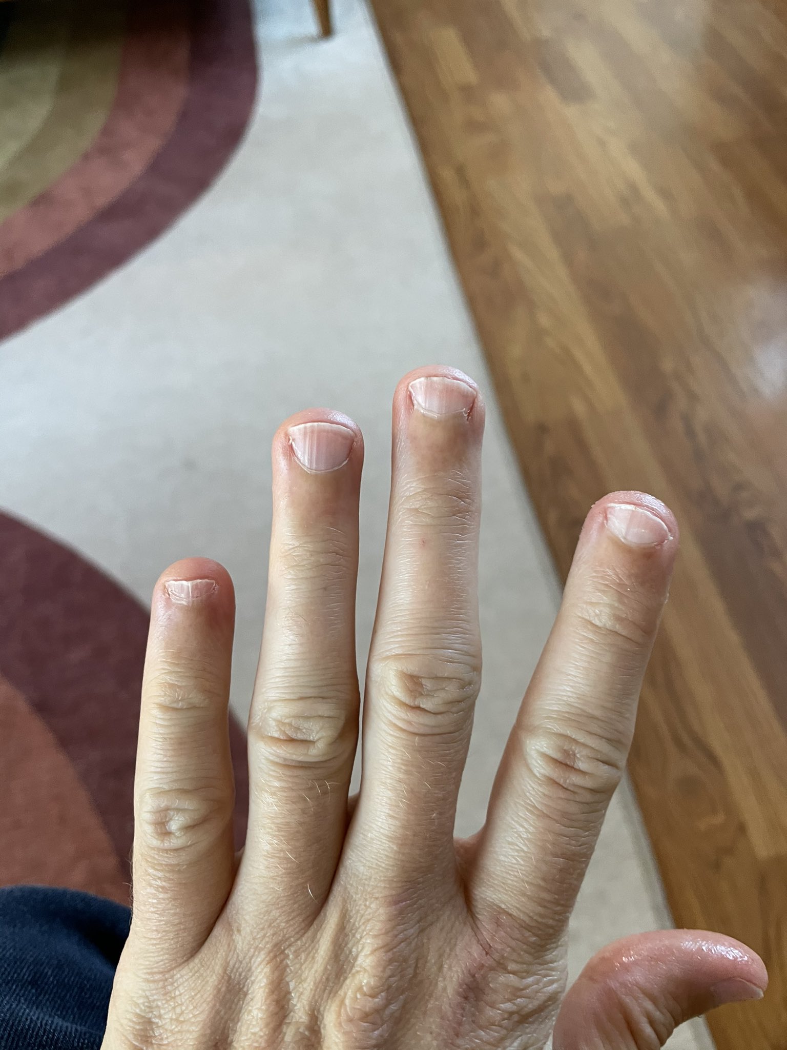 Top more than 109 nails turning purple songngunhatanh.edu.vn