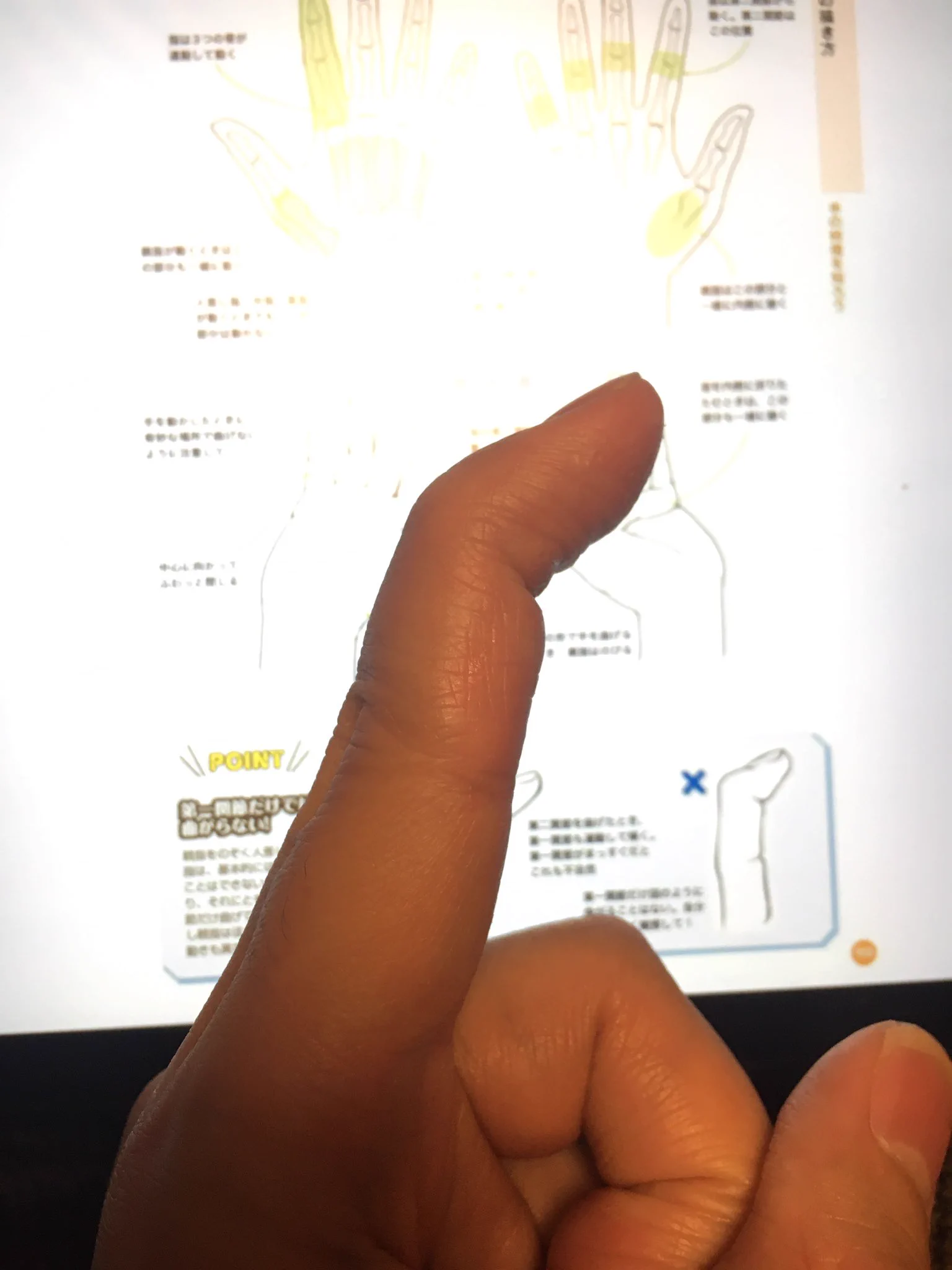 手の指の第一関節だけが曲げられる！？どうなってるの