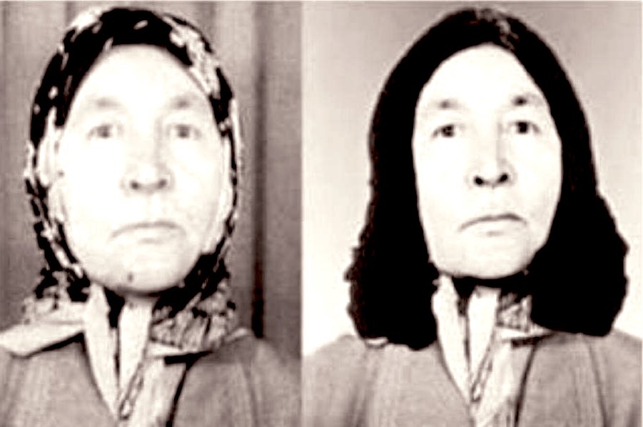 Medine Bircan ismi tek başına 28 Şubat’ın özetidir. Hastaydı.. Sağlık karnesindeki fotoğraf başörtülü diye tedavi edilmedi. Başı açık fotoğraflı karne istendi. Oğlu fotomontajla peruk yerleştirdi. Tüm bunlar olurken Medine Bircan hayatını kaybetti! #28Şubat #28SubatDeyinceAklıma