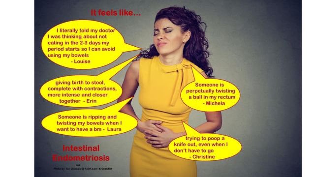 XtraNotRare's tweet image. Last day before Endometriosis Awareness Month 2021 commences. Final recap memes of 2020.  #Endometriosis #ExtrapelvicEndometriosis #ExtrapelvicNotRare #WeAreExtraNotRare